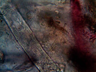 Duşumun altındaki boruda bulunan mikroorganizma.