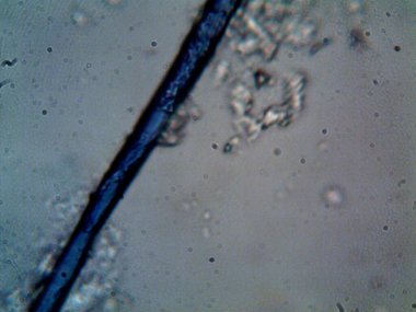 Duşumun altındaki boruda bulunan mikroorganizma.