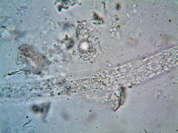 Μικροοργανισμός Βρέθηκε Σωλήνα Κάτω Από Ντους Μου — Φωτογραφία Αρχείου