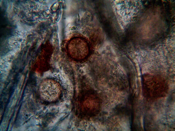 Duşumun Altındaki Boruda Bulunan Mikroorganizma — Stok fotoğraf