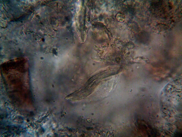 Mikroorganismus Nalezen Trubce Pod Sprchou — Stock fotografie