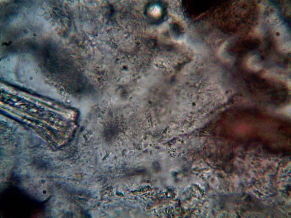 Mikroorganizm Znaleziony Rurze Pod Prysznicem — Zdjęcie stockowe