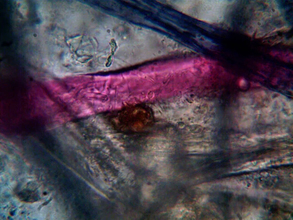 Mikroorganismus Nalezen Trubce Pod Sprchou — Stock fotografie