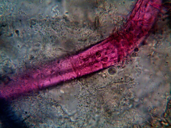 Микроорганизм Найденный Трубе Моим Душем — стоковое фото