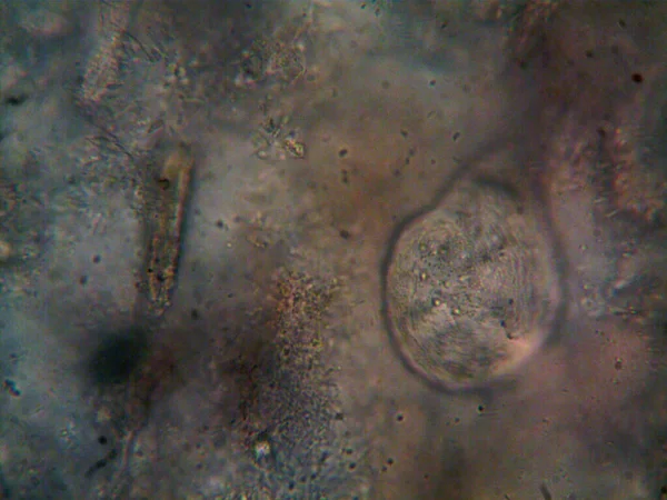 Mikroorganizmus Talált Cső Alatt Zuhany — Stock Fotó