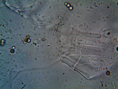 Duşumun altındaki boruda bulunan mikroorganizma.