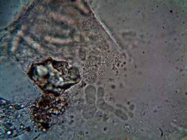 Duşumun altındaki boruda bulunan mikroorganizma.