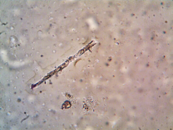 在我淋浴间的管子里发现的微生物 — 图库照片