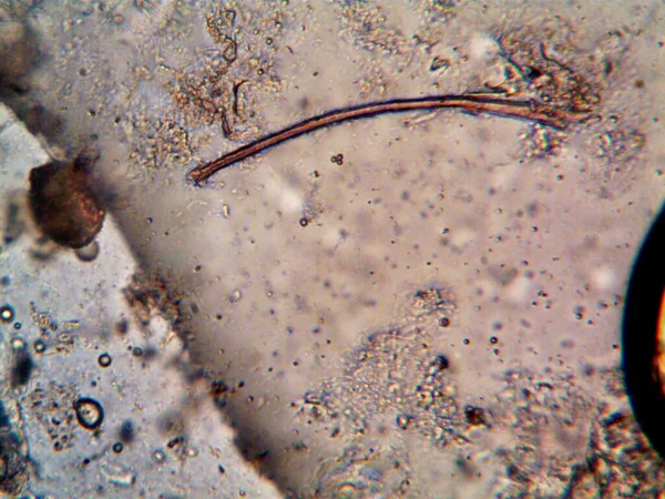 Microorganismo Encontrado Tubería Bajo Ducha —  Fotos de Stock