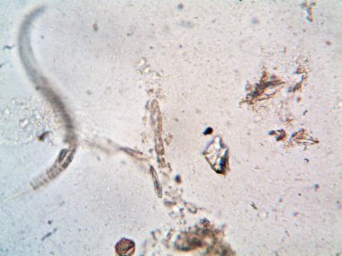 Duşumun altındaki boruda bulunan mikroorganizma.
