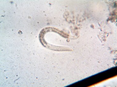 Duşumun altındaki boruda bulunan mikroorganizma.