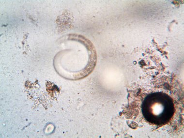 Duşumun altındaki boruda bulunan mikroorganizma.