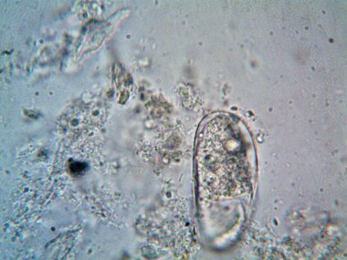 Duşumun altındaki boruda bulunan mikroorganizma.