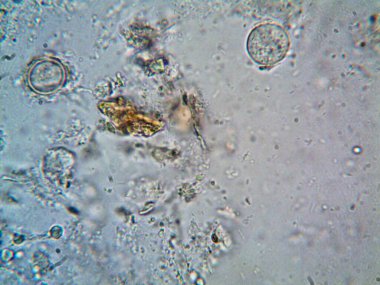 Duşumun altındaki boruda bulunan mikroorganizma.