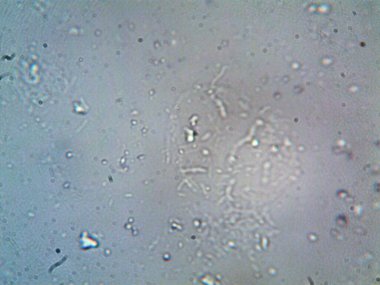 Duşumun altındaki boruda bulunan mikroorganizma.
