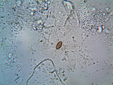 Duşumun altındaki boruda bulunan mikroorganizma.