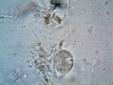 Duşumun altındaki boruda bulunan mikroorganizma.