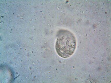 Duşumun altındaki boruda bulunan mikroorganizma.