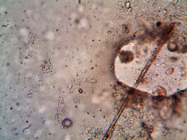 Duşumun altındaki boruda bulunan mikroorganizma.