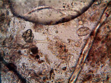 Duşumun altındaki boruda bulunan mikroorganizma.