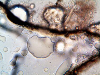 Duşumun altındaki boruda bulunan mikroorganizma.