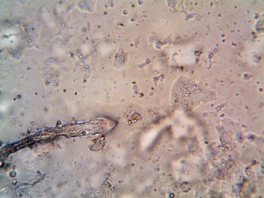 Duşumun altındaki boruda bulunan mikroorganizma.