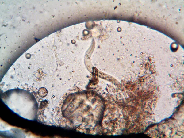 私のシャワーの下のパイプに見つかった微生物 — ストック写真
