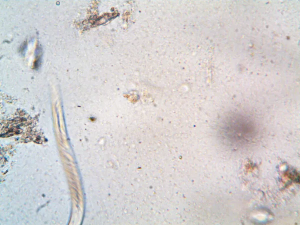 Мікроорганізм Знайдений Трубі Під Моїм Душем — стокове фото