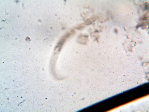 Микроорганизм Найденный Трубе Моим Душем — стоковое фото