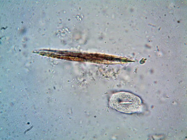 Microorganismo Encontrado Tubería Bajo Ducha —  Fotos de Stock