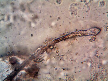 Duşumun altındaki boruda bulunan mikroorganizma.