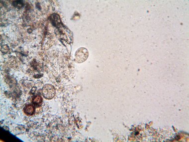 Duşumun altındaki boruda bulunan mikroorganizma.
