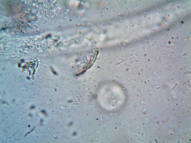 Mikroskopla görülen doğal şeyler.