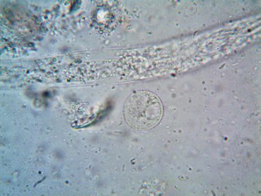 Mikroskopla görülen doğal şeyler.