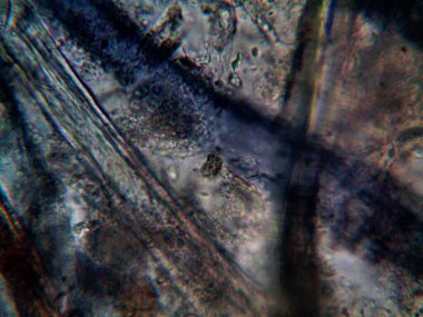 Mikroskopla görülen doğal şeyler.