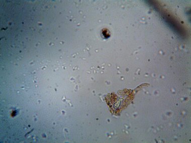 Mikroskopla görülen doğal şeyler.