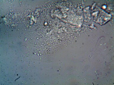 Mikroskopla görülen doğal şeyler.