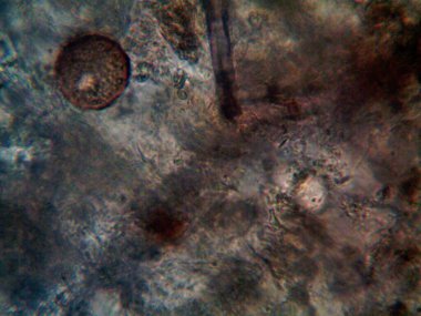 Mikroskopla görülen doğal şeyler.