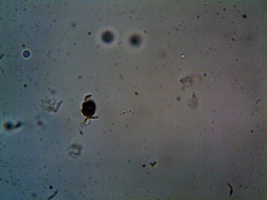 Mikroskopla görülen doğal şeyler.