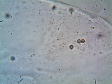 Mikroskopla görülen doğal şeyler.