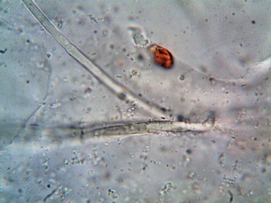 Mikroskopla görülen doğal şeyler.