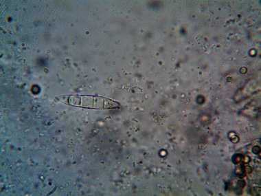 Mikroskopla görülen doğal şeyler.