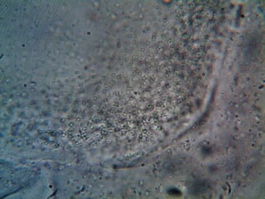 Mikroskopla görülen doğal şeyler.