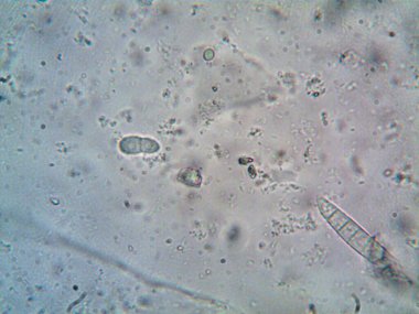 Mikroskopla görülen doğal şeyler.