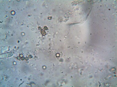 Mikroskopla görülen doğal şeyler.