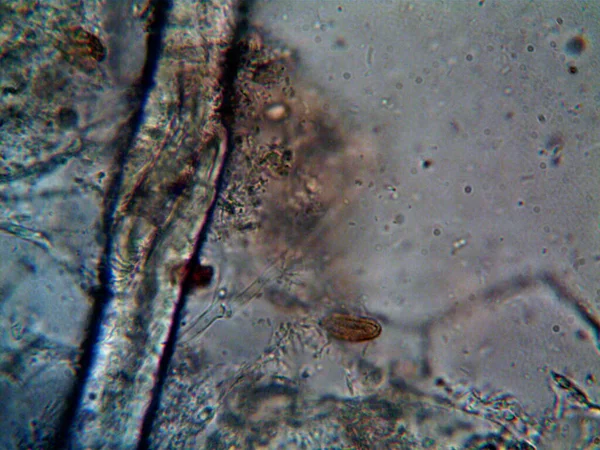 현미경으로 그대로 의것들 — 스톡 사진