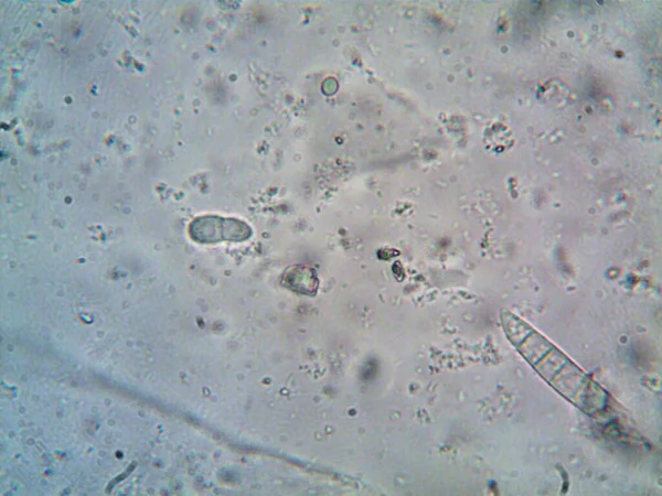 현미경으로 그대로 의것들 — 스톡 사진