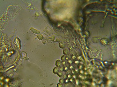 Mikroskopla görülen doğal şeyler.