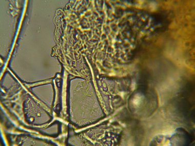 Mikroskopla görülen doğal şeyler.