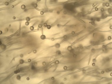 Mikroskopla görülen doğal şeyler.